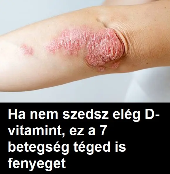 dvitamin 78