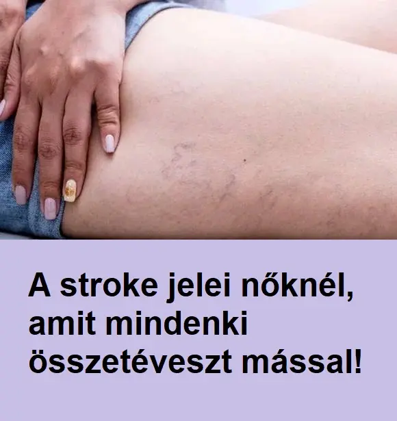 noistroke154
