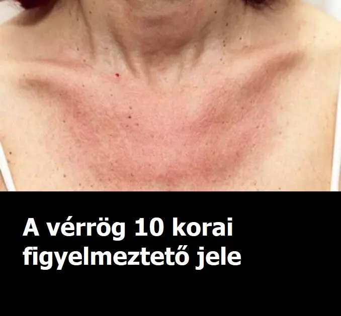 verrogx3jpg